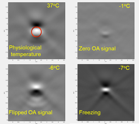 Optoacoustic Temperature Imaging